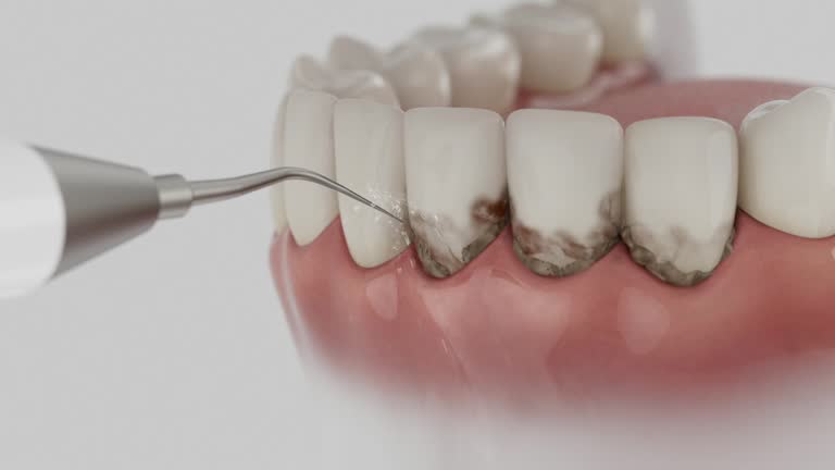 Reliable Dental Implants contractor in Garland County County, AR by Dentist Open Now